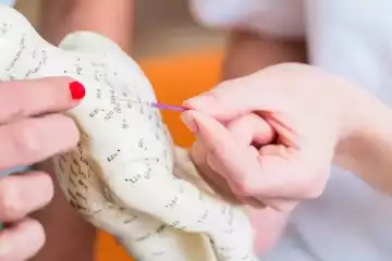 בחירת מטפל ברפואה סינית באשדוד: מדריך מעשי